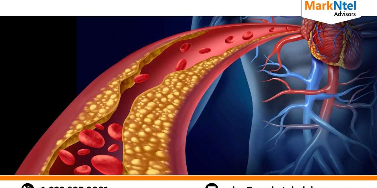 Unveiling the Expert’s Perspective for Hypercholesterolemia Market Outlook 2028