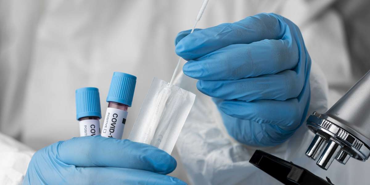 COVID Antibody Test Cost