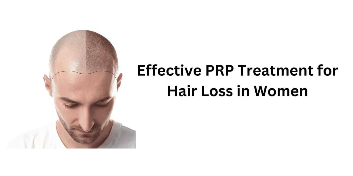 Effective PRP Treatment for Hair Loss in Women