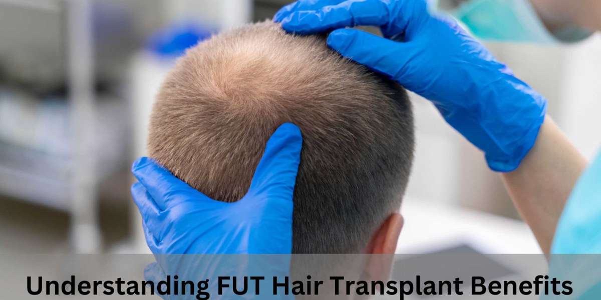 Understanding FUT Hair Transplant Benefits