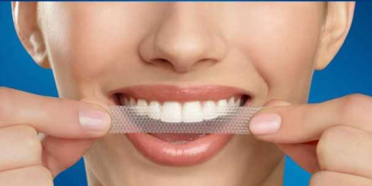 Crest Teeth Whitening Strips UK: Customer Reviews and Before-and-After Results