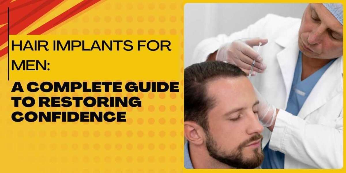 Hair Implants for Men: A Complete Guide to Restoring Confidence